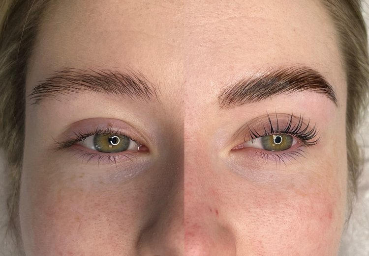 Brow Lamination